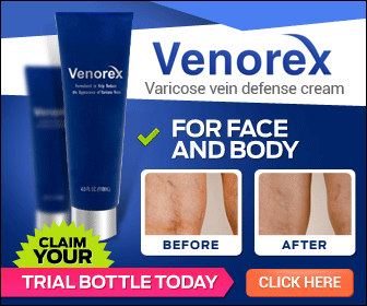 Surgical Treatment Of Varicose Veins
