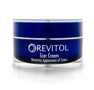 What are some good creams to remove scars?